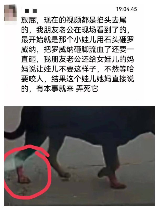 #最安全国度 #狗咬人 狗主人有钱有势 被咬女孩家长被污名敛财 先污名化受害人，再洗白加害人，真当网友是白痴？#最安全国度 #狗咬人 狗主人有钱有势 被咬女孩家长被污名敛财 先污名化受害人，再洗白加害人，真当网友是白痴？