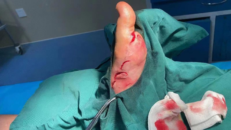 百度热搜榜TOP1广西 #北海 一浴场突发 #不明鱼类伤人事件，官方: 暂停涉水活动鱼？灯泡？百度热搜榜TOP1广西 #北海 一浴场突发 #不明鱼类伤人事件，官方: 暂停涉水活动鱼？灯泡？