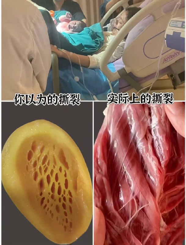 #保罗在美国 妻子大出血被怼脸拍 ，拿老婆博流量 #网红翻车保罗在美国：把妻子当素材，底线在哪妻子产后大出血，接近全身血换一遍，人都在抢救室生死边缘，他第一反应不是守着、不是心疼，而是怼脸拍视频、插广告、赚流量