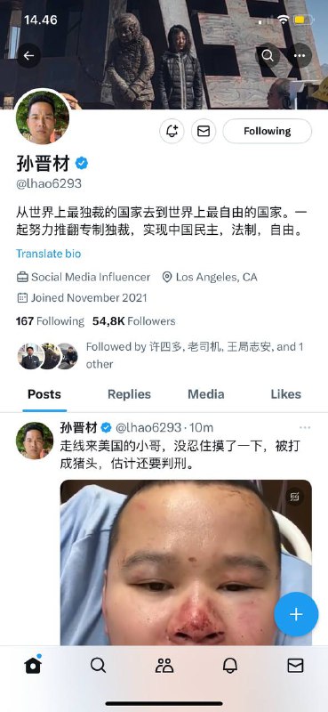 #走线/偷渡🇨🇳人来美国🇺🇸没忍住摸了一下，被打成猪头，估计还要判刑