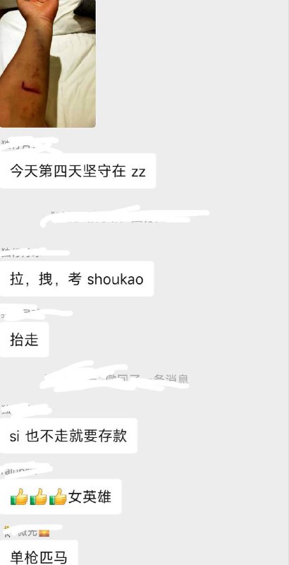 #河南村镇银行 一个女储户在郑州的遭遇   她，一个人，为了存款，更是为了心中对正义的信念，独自在郑州，在非人的折磨下坚持了四天！这张照片手臂上的累累伤痕，恍惚间还以为江姐在渣滓洞遭受毒打