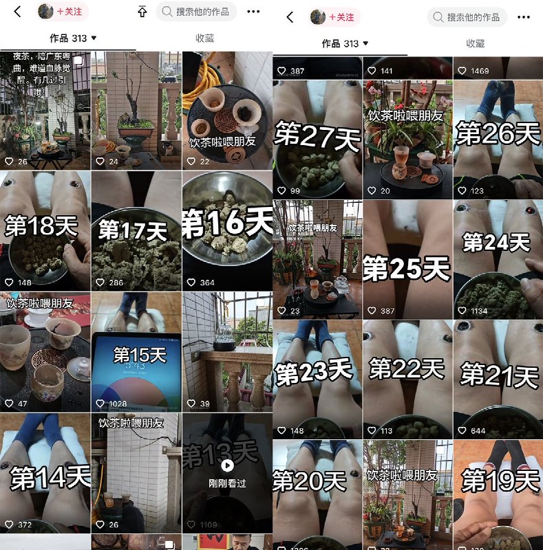 广东中山一名男子自学中医，每天用艾灸灼烧自己的双腿，并用视频记录下每天艾灸的过程以及身体变化
