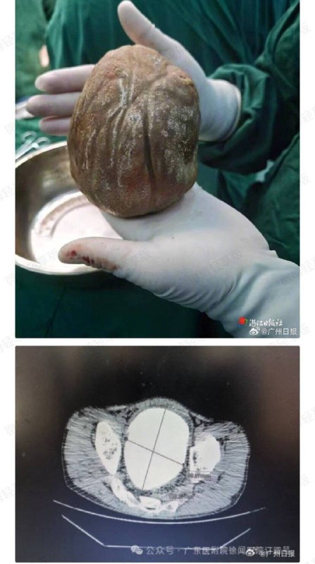 金丹后期大圆满，马上就要结婴了感谢家人们投稿！金丹后期大圆满，马上就要结婴了感谢家人们投稿！