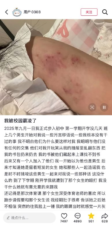 5月10日，一名来自安徽合肥的女孩，讲述自己上初中后遭到校园霸凌的经历，并晒出了被同学们打到淤青的身体，随后抖音出手，清空了所有评论，并删除了女孩发布的贴文